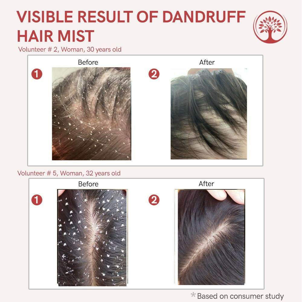 Ivory Natural Dandruff Hair Mist For Flake-Free Confidence And Silky Smooth Hair - Distacart