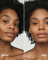 Thumbnail for Clinique Even Better Clinical Serum Foundation SPF 20 - WN 80 Tawnied Beige (M) - Distacart