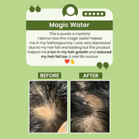 Thumbnail for Alps Goodness Rosemary Water for Hair Regrowth - Distacart