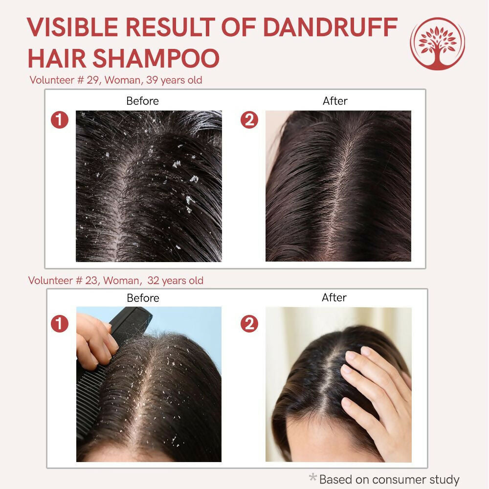 Ivory Natural Dandruff Shampoo - Embrace A Rejuvenated Scalp - Distacart