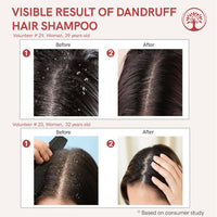 Thumbnail for Ivory Natural Dandruff Shampoo - Embrace A Rejuvenated Scalp - Distacart