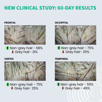 Thumbnail for ThriveCo Anti-Greying Hair Prime Serum - Distacart