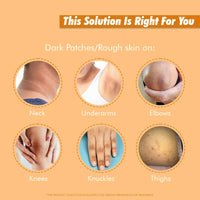 Thumbnail for Exposed Whitening Cream For Intimate Areas Dark Underarms Elbows, Neck - Distacart