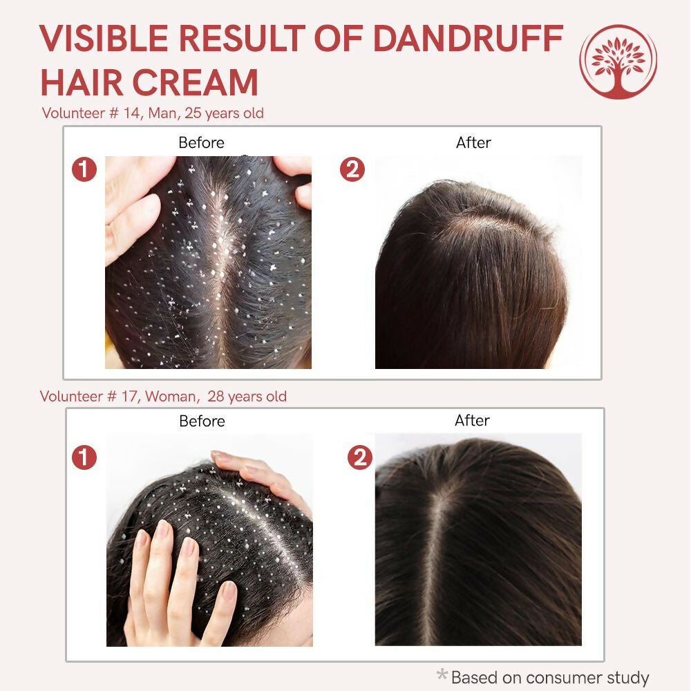 Ivory Natural Dandruff Hair Cream For Dandruff, And Nourishing Dry Scalp - Distacart