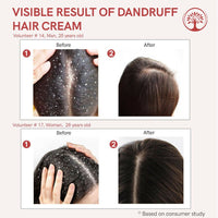 Thumbnail for Ivory Natural Dandruff Hair Cream For Dandruff, And Nourishing Dry Scalp - Distacart